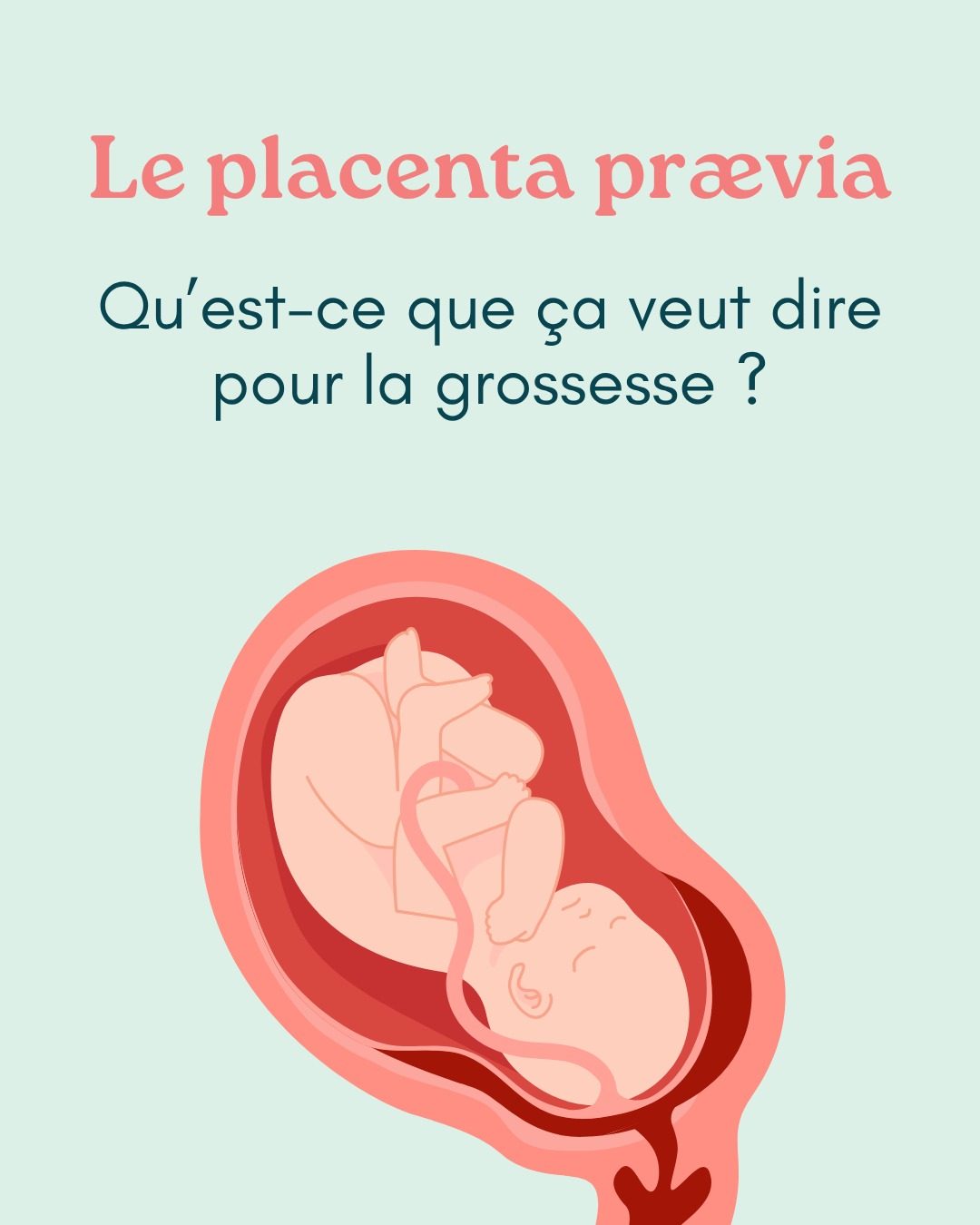Le terme "placenta prævia" peut surprendre lorsqu’il apparaît sur un compte-rendu d’échographie… mais que signifie-t-il vraiment ?